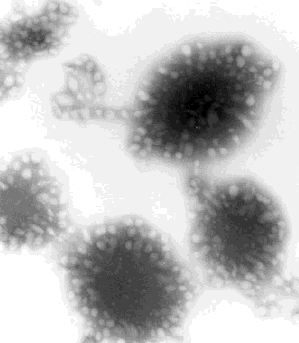 transmission electron micrograph of osmium tetroxide-stained cryo-ultramicrotome section of natural rubber latex/poly(methyl methacrylate) composite particles